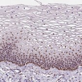 Anti-C1orf112 antibody produced in rabbit Prestige Antibodies® Powered by Atlas Antibodies, affinity isolated antibody, buffered aqueous glycerol solution, Ab1