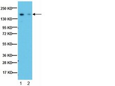 Anti-IGF-IR Antibody, β-subunit, clone 1-2 clone 1-2, from mouse, purified by affinity chromatography