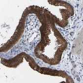Anti-SCNN1A antibody produced in rabbit Prestige Antibodies® Powered by Atlas Antibodies, affinity isolated antibody, buffered aqueous glycerol solution