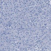Anti-HHATL antibody produced in rabbit Prestige Antibodies® Powered by Atlas Antibodies, affinity isolated antibody, buffered aqueous glycerol solution