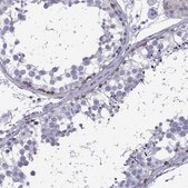 Anti-FBXO24 antibody produced in rabbit Prestige Antibodies® Powered by Atlas Antibodies, affinity isolated antibody, buffered aqueous glycerol solution