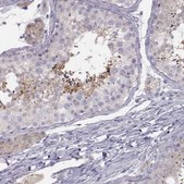 Anti-ACSL6 antibody produced in rabbit affinity isolated antibody, buffered aqueous glycerol solution