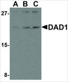 Anti-DAD1 antibody produced in rabbit affinity isolated antibody, buffered aqueous solution