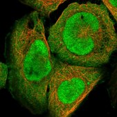 Anti-DNAJC9 antibody produced in rabbit Prestige Antibodies® Powered by Atlas Antibodies, affinity isolated antibody, buffered aqueous glycerol solution