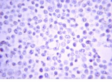 Anti-IKKβ Antibody from rabbit