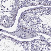 Anti-DNAH17 Prestige Antibodies® Powered by Atlas Antibodies, affinity isolated antibody