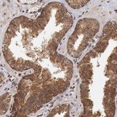 Anti-STX17 antibody produced in rabbit Prestige Antibodies® Powered by Atlas Antibodies, affinity isolated antibody, buffered aqueous glycerol solution