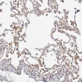 Anti-SERTAD4 antibody produced in rabbit Prestige Antibodies® Powered by Atlas Antibodies, affinity isolated antibody, buffered aqueous glycerol solution, ab2