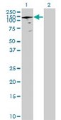 Anti-ANAPC2 antibody produced in mouse purified immunoglobulin, buffered aqueous solution