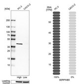Anti-SERPINB5 antibody produced in rabbit Prestige Antibodies® Powered by Atlas Antibodies, affinity isolated antibody, buffered aqueous glycerol solution