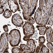 Anti-RAD23B antibody produced in rabbit Prestige Antibodies® Powered by Atlas Antibodies, affinity isolated antibody, buffered aqueous glycerol solution, ab3