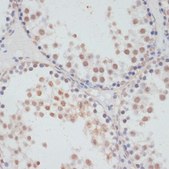 Anti-Phospho-RPS6KA5-S376 antibody produced in rabbit