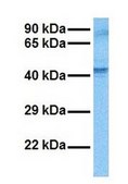 Anti-PITX2 IgG fraction of antiserum