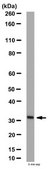Anti-TIMP-3 Antibody, CT from rabbit, purified by affinity chromatography