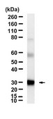Anti-HIF-2α/EPAS1 Antibody, clone 2L21 ZooMAb® Rabbit Monoclonal recombinant, expressed in HEK 293 cells