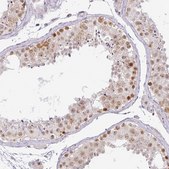Anti-PARP2 antibody produced in rabbit Prestige Antibodies® Powered by Atlas Antibodies, affinity isolated antibody, buffered aqueous glycerol solution