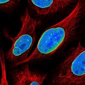 Anti-C6orf141 antibody produced in rabbit Prestige Antibodies® Powered by Atlas Antibodies, affinity isolated antibody, buffered aqueous glycerol solution
