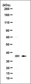 Anti-LOX-1, clone 9E12.1 clone 9E12.1, from mouse