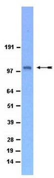 Anti-QIK (SIK2) Antibody Upstate&#174;, from rabbit