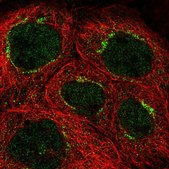 Anti-CEP83 antibody produced in rabbit Prestige Antibodies® Powered by Atlas Antibodies, affinity isolated antibody, buffered aqueous glycerol solution