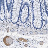 Anti-APOL1 antibody produced in rabbit Prestige Antibodies® Powered by Atlas Antibodies, affinity isolated antibody, buffered aqueous glycerol solution