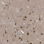 Anti-SLC12A6 antibody produced in rabbit Prestige Antibodies® Powered by Atlas Antibodies, affinity isolated antibody, buffered aqueous glycerol solution