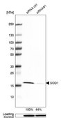 抗SOD1 ウサギ宿主抗体 Prestige Antibodies® Powered by Atlas Antibodies, affinity isolated antibody, buffered aqueous glycerol solution