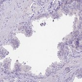 Anti-LDB3 antibody produced in rabbit Prestige Antibodies® Powered by Atlas Antibodies, affinity isolated antibody, buffered aqueous glycerol solution