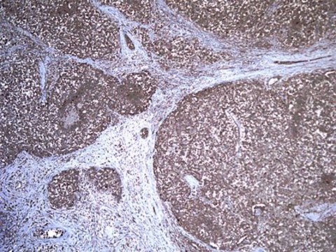 Anti-Desert hedgehog protein (DHH) Antibody, clone 19D7.2 clone 19D7.2, from mouse