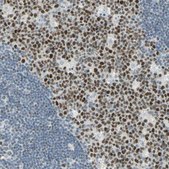 Anti-BCL6 antibody produced in rabbit Prestige Antibodies® Powered by Atlas Antibodies, affinity isolated antibody, buffered aqueous glycerol solution
