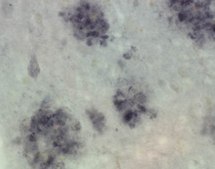 Anti-Presenilin-1 Antibody, NT, clone hPS1-NT culture supernatant, clone hPS1-NT, Chemicon®