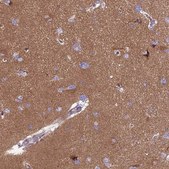 Anti-PPFIA3 antibody produced in rabbit Prestige Antibodies® Powered by Atlas Antibodies, affinity isolated antibody, buffered aqueous glycerol solution