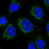 Anti-NDUFAF8 antibody produced in rabbit Prestige Antibodies® Powered by Atlas Antibodies, affinity isolated antibody, buffered aqueous glycerol solution