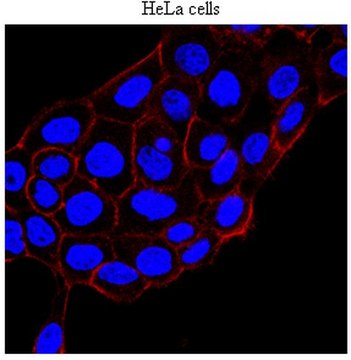 Anti-KRIT-1 Antibody, clone 15 clone 15B2, from mouse