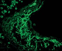 Anti-Tenascin Antibody Chemicon®, from rabbit