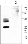 抗水チャネルアクアポリン2 ウサギ宿主抗体 IgG fraction of antiserum, lyophilized powder