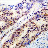 Anti-phospho-Estrogen Receptor-α (pSer118) antibody produced in rabbit affinity isolated antibody