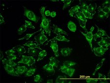 Monoclonal Anti-ACBD3 antibody produced in mouse clone 2G2, purified immunoglobulin, buffered aqueous solution