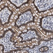 Anti-DDX41 antibody produced in rabbit Prestige Antibodies® Powered by Atlas Antibodies, affinity isolated antibody, buffered aqueous glycerol solution