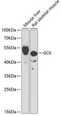Anti-GCK antibody produced in rabbit