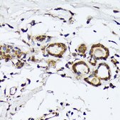 Anti-PSMD14 antibody produced in rabbit