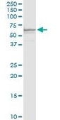 Anti-SLC40A1 antibody produced in rabbit purified immunoglobulin, buffered aqueous solution