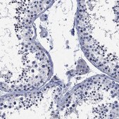 Anti-SLC4A4 antibody produced in rabbit Prestige Antibodies® Powered by Atlas Antibodies, affinity isolated antibody, buffered aqueous glycerol solution