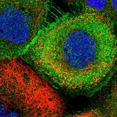 Anti-ZBTB8OS antibody produced in rabbit Prestige Antibodies® Powered by Atlas Antibodies, affinity isolated antibody, buffered aqueous glycerol solution