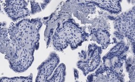 Anti-ITIH1 Antibody, clone 1K16 ZooMAb® Rabbit Monoclonal recombinant, expressed in HEK 293 cells