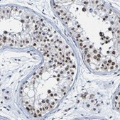 Anti-PCGF1 antibody produced in rabbit Prestige Antibodies® Powered by Atlas Antibodies, affinity isolated antibody, buffered aqueous glycerol solution