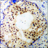 Anti-phospho-Estrogen Receptor-α (pSer118) antibody produced in rabbit affinity isolated antibody
