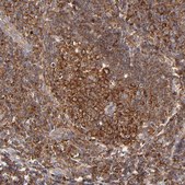 Anti-FARSA antibody produced in rabbit Prestige Antibodies® Powered by Atlas Antibodies, affinity isolated antibody, buffered aqueous glycerol solution