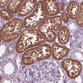 Anti-SLC27A2 antibody produced in rabbit Prestige Antibodies® Powered by Atlas Antibodies, affinity isolated antibody, buffered aqueous glycerol solution