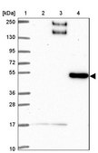 Anti-BEND5 antibody produced in rabbit Prestige Antibodies® Powered by Atlas Antibodies, affinity isolated antibody, buffered aqueous glycerol solution